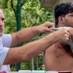 राहुल गांधी पैलेट गन FIR